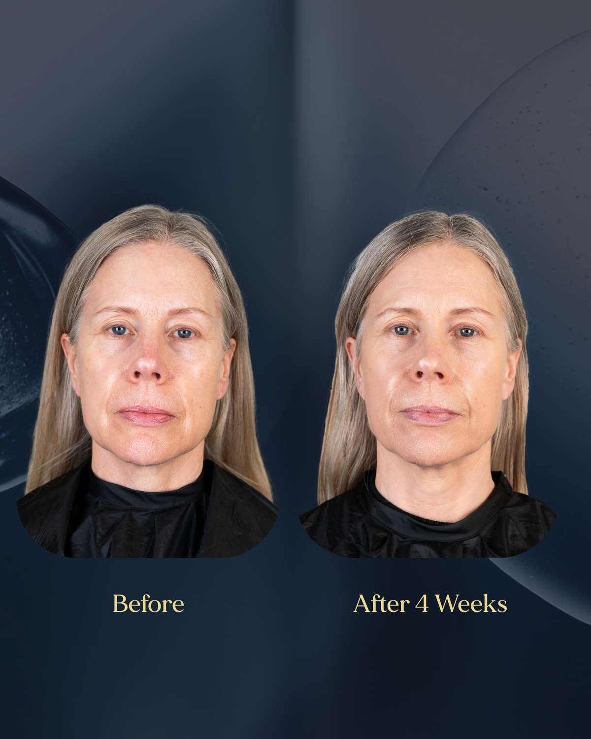 Before and after 4 weeks of using The Face Barrier Serum