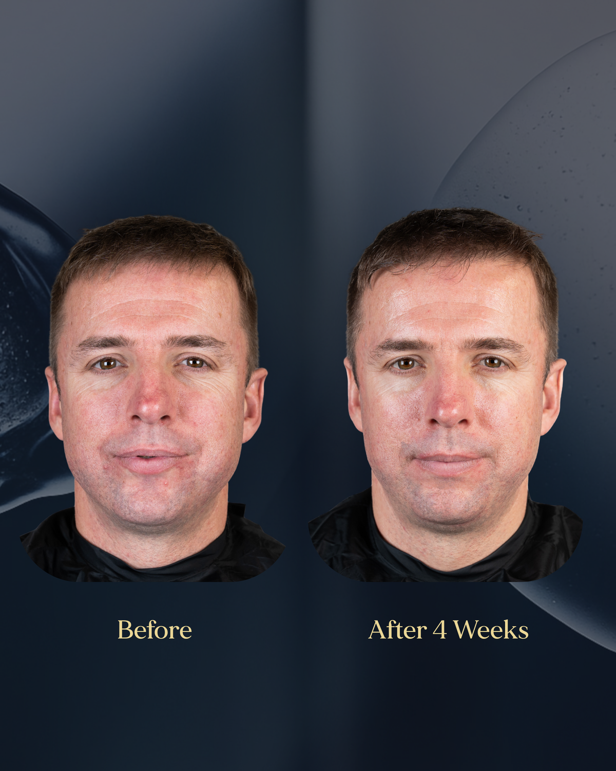 Before and after 4 weeks of using The Face Barrier Serum