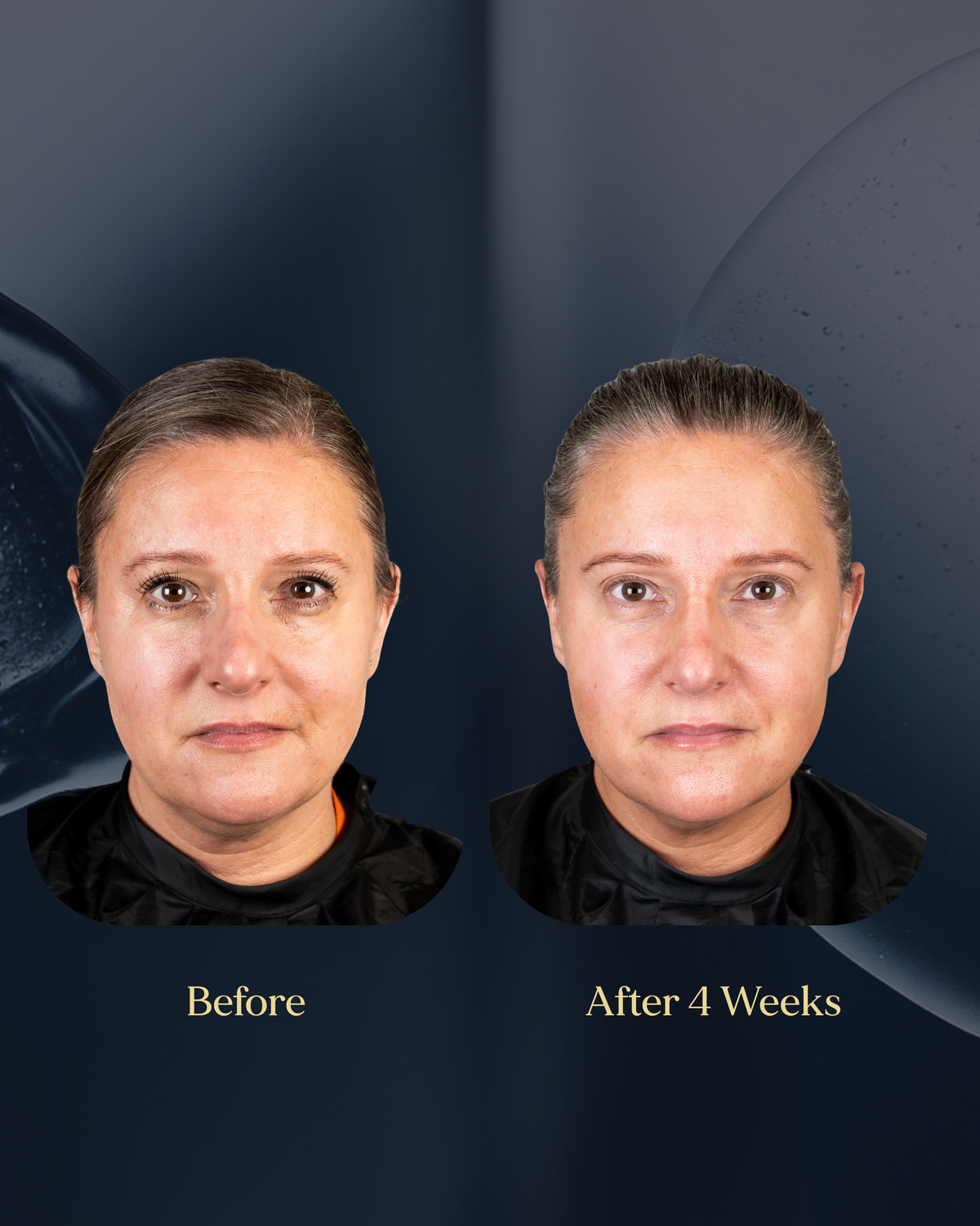 Before and after 4 weeks of using The Face Barrier Serum